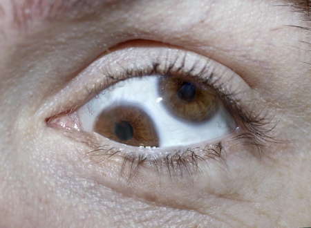 olafure-liasson-72-double-vision-eyeball